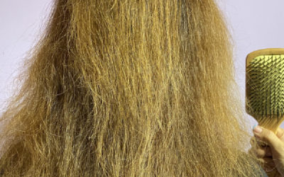 Dry Hair: Causes and Treatments